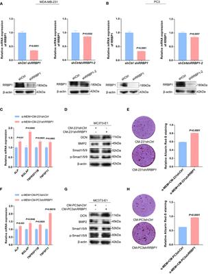 RRBP1 depletion of bone metastatic cancer cells contributes to enhanced expression of the osteoblastic phenotype